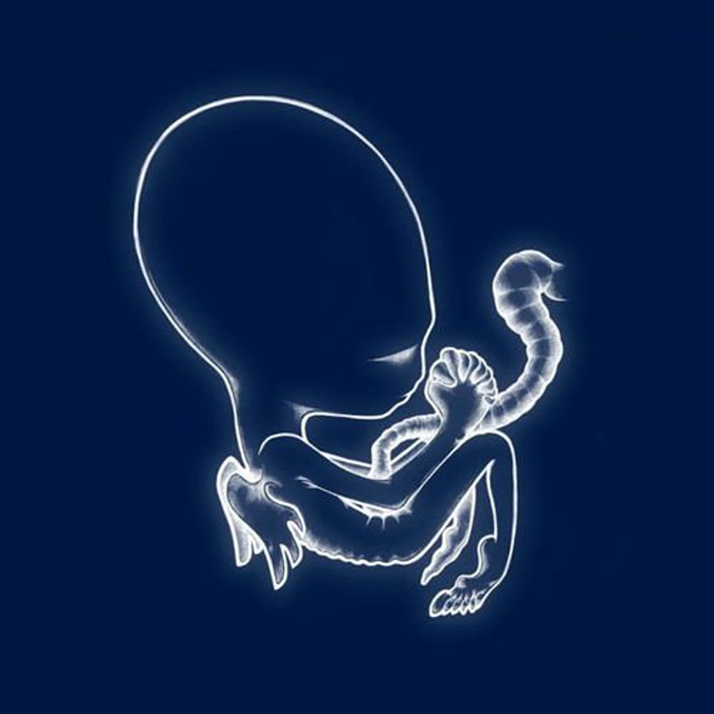欧2LP Sigur Ros Agatis Byrjun KRUNK8LP Krunk 未開封 /00520 Sigur Rós – Ágætis Byrjun – 2 x Vinyl (LP, Album + 2 more